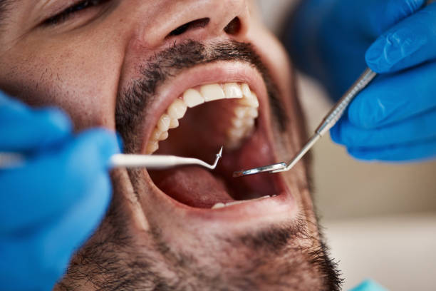 Best Emergency Dental Care for Trauma or Injury in Rome, GA